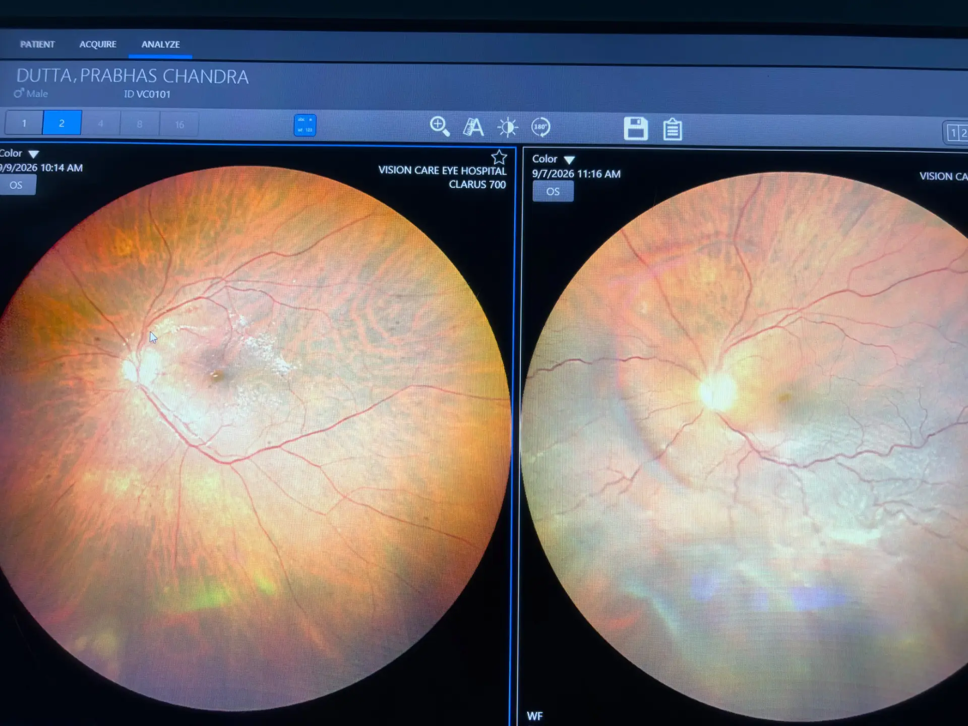 Retinal Examination