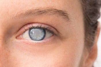 Eye examination