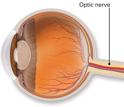 Eye examination