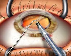 Modern surgical equipment