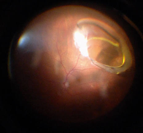 Eye care consultation